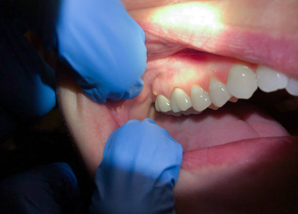 Best Emergency Cosmetic Dentistry in Brentwood, CA